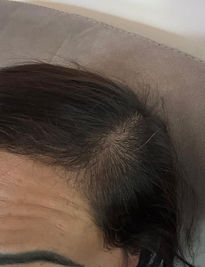 Hair after treatment