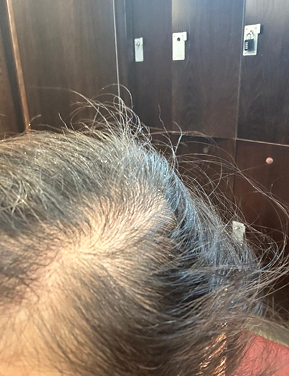 Hair before treatment