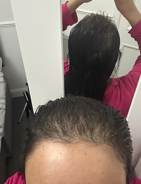 Hair before treatment